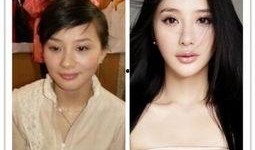 爆料女星削骨视频播放在线观看,女星削骨手术全过程，惊悚视频在线观看